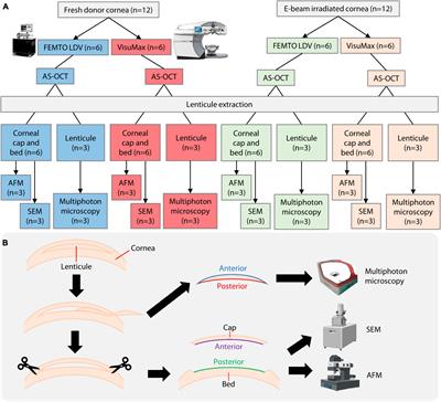 Incisional surface quality of electron-beam irradiated cornea-extracted lenticule for stromal keratophakia: high nJ-energy vs. low nJ-energy femtosecond laser